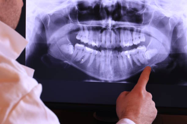 Best Emergency Dental Services for Seniors in Snyderville, UT