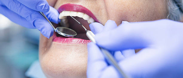 Best Emergency Dentist for Knocked-Out Tooth in Snyderville, UT