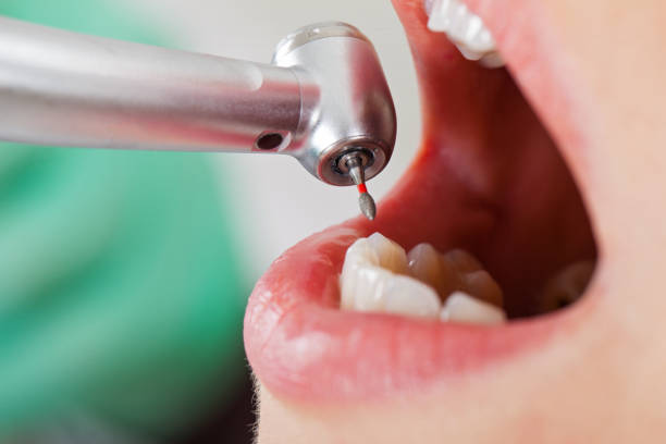 Best Pediatric Emergency Dentist in Snyderville, UT